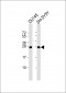 UCHL1 Antibody (N-term)