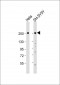 ROBO1 Antibody (C-Term)