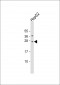 CIDEB Antibody (C-erm)