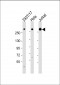 IGF2R Antibody (C-Term)