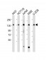 TACC3 Antibody (Center)