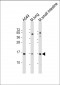 PLA2G2A Antibody (N-Term)