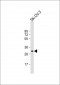 IGFBP5 Antibody (Center)