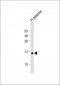 GHRL Antibody (N-Term)