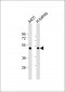 ZMPSTE24 Antibody (Center)