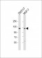 VE Cadherin Antibody (CDH5) (N-term)