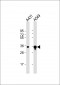 AKR1B1 Antibody (Center)