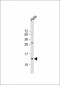 B2M Antibody (N-term)