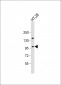 ATXN1 Antibody (S776)