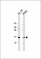 SNRPD1 Antibody (C-term)