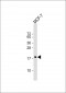 CFL1 Antibody (Center)