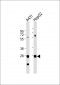 TPI1 Antibody (N-term)