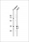BIRC7 Antibody (C-term)