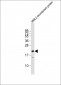 MLL2 Antibody (C-term)