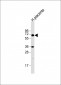 IL1R Antibody (C-term E487)