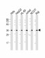 OGG1 Antibody (C-term)