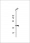 PBK Antibody (C-term C300)