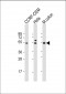 CHK1 Antibody (C-term)