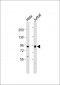 ACO2 Antibody (Center)