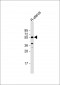 Aromatase (CYP19A1) Antibody (C-term)