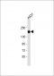 EGFR Antibody