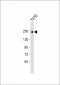 ERBB2 Antibody(C-term Y1248)
