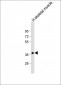 TRIB1 Antibody (C-term)