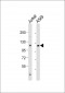 NIK Antibody (Center)