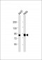 TLK1 Antibody (C-term)