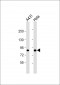 TLK1 Antibody (C-term)