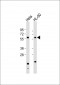 Natriuretic Peptide Receptor C Antibody (N-term)
