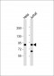 PFKP Antibody (C-term)