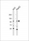 AP8551c-AP2A2-Antibody-Center