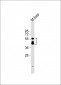 KMO Antibody (Center)