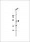 NR1I2 Antibody (Center)