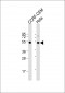 TBB1 Antibody