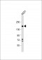 ITGA2 Antibody (C-term)