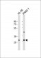 RGR Antibody (Center)