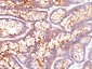  Carcinoembryonic Antigen (CEA) / CD66 Antibody - With BSA and Azide