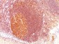  MALT1 (MALT-Lymphoma Marker) Antibody - With BSA and Azide