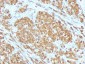  MART-1 / Melan-A / MLANA (Melanoma Marker) Antibody - With BSA and Azide
