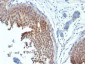 Cytokeratin 6 (KRT6) (Hyperproliferation-Related Keratin) Antibody - With BSA and Azide