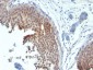  Cytokeratin 6 (KRT6) (Hyperproliferation-Related Keratin) Antibody - With BSA and Azide