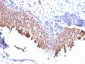  Cytokeratin 10 (KRT10) (Suprabasal Epithelial Marker) Antibody - With BSA and Azide