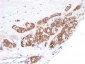  Cytokeratin 18 (KRT18) Antibody - With BSA and Azide