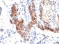  FOXP3 (Forkhead Box Protein P3) / Scurfin Antibody - With BSA and Azide