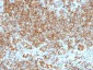  CD45 / LCA (Leucocyte Marker) Antibody - With BSA and Azide