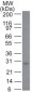  Bcl-2 (Apoptosis & Follicular Lymphoma Marker) Antibody - With BSA and Azide