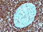  Bcl-2 (Apoptosis & Follicular Lymphoma Marker) Antibody - With BSA and Azide