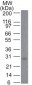  Bcl-2 (Apoptosis & Follicular Lymphoma Marker) Antibody - With BSA and Azide